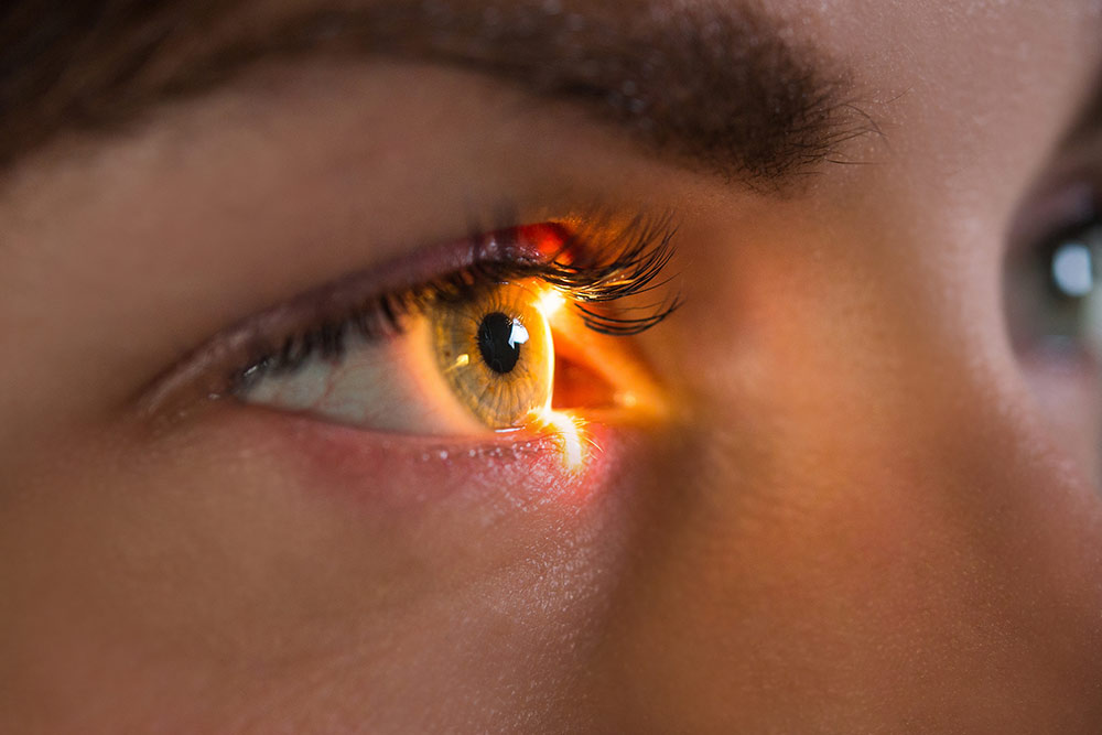 R&eacute;tine Visiop&ocirc;le du Beaujolais