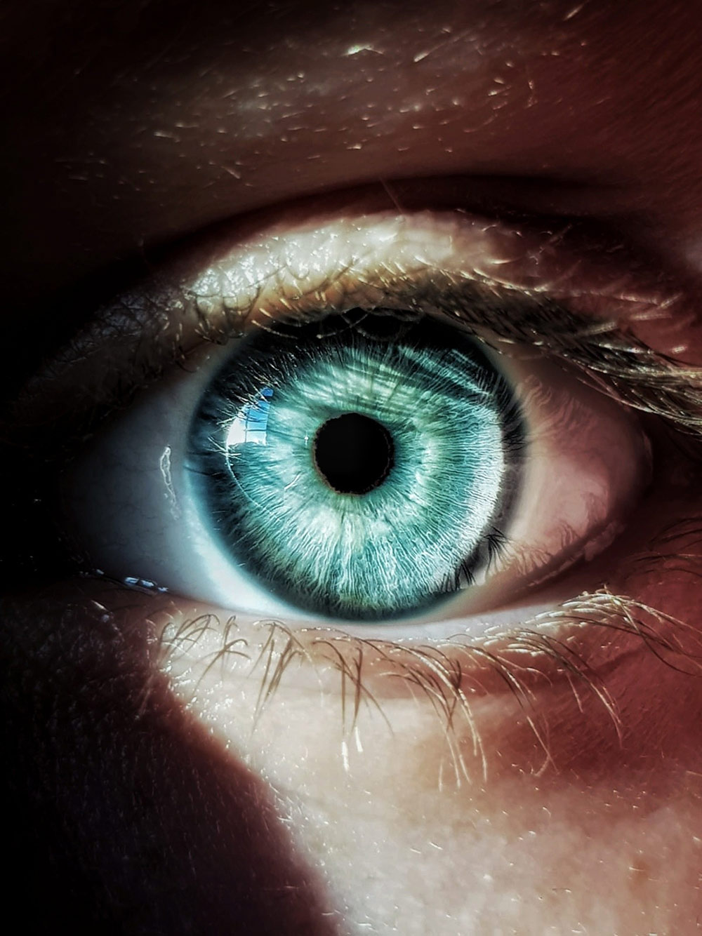 Les facteurs de risque du d&eacute;collement de la r&eacute;tine