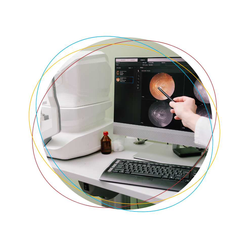 OCT maculaire - Visiop&ocirc;le du Beaujolais