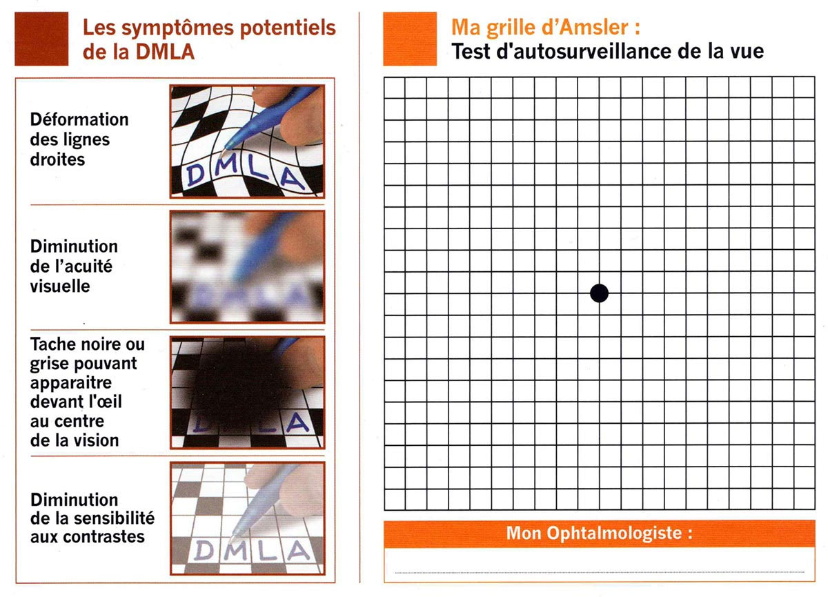 Grille d'Amsler DMLA