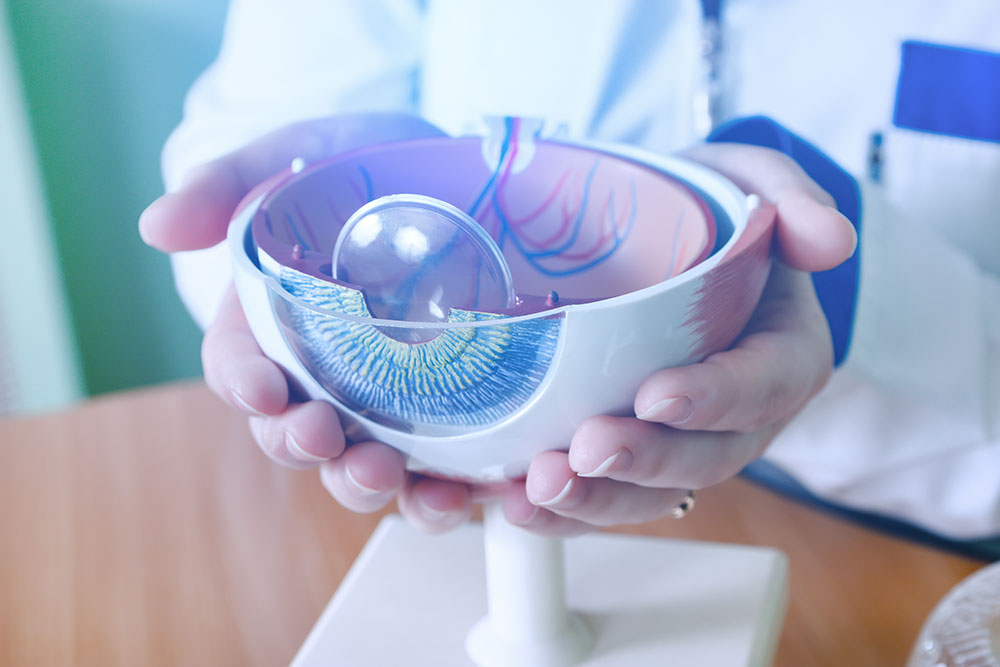 Implants cataracte d&eacute;finition