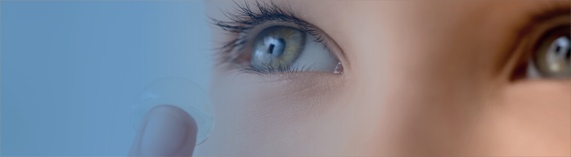 L&rsquo;orthok&eacute;ratologie