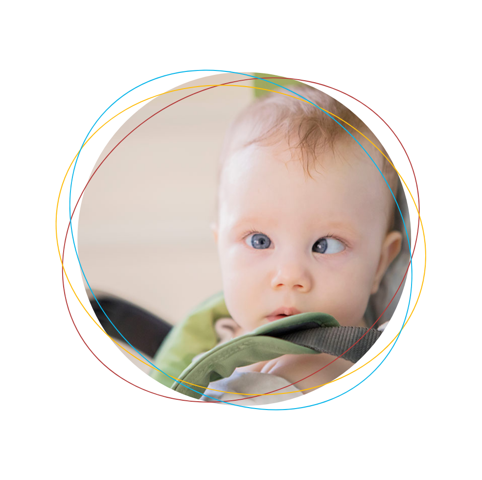 Strabisme de l'enfant