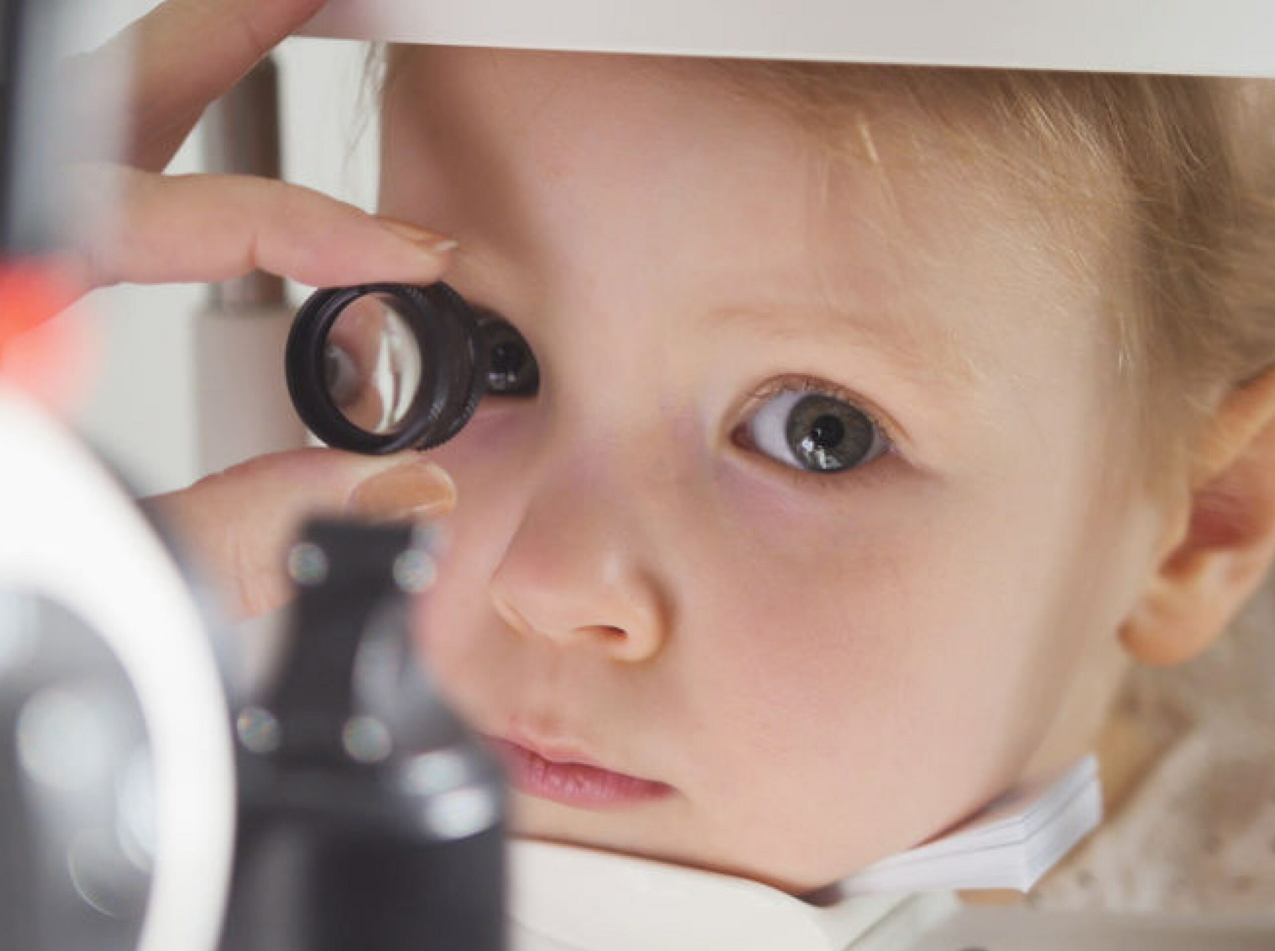 Ophtalmologie pédiatrique | Visiopôle du Beaujolais | rdv ophtalmo bébé | Villefranche-sur-Saône
